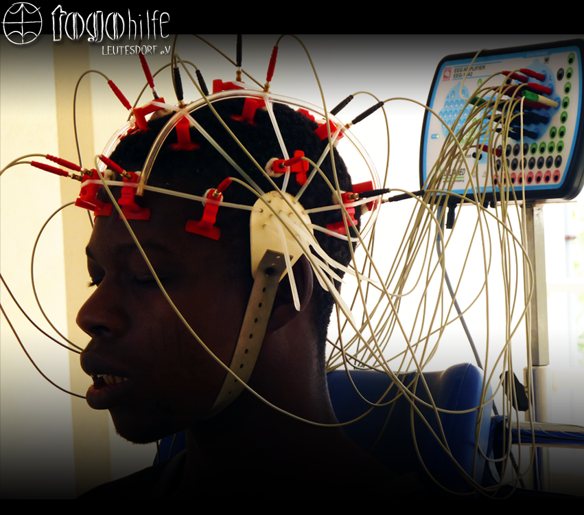 Epilepsieprojekt